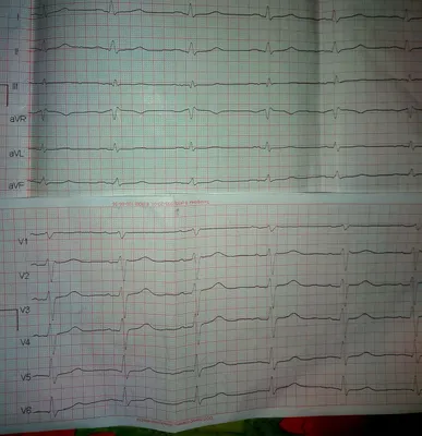 Дела житейские #43: ЭКГ | Пикабу
