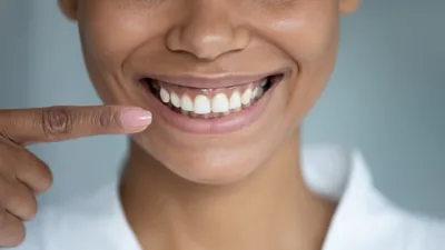Как лучше убрать диастему и сколы на передних зубах? | Альянс  бьюти-ортопедов, Москва