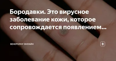 Удаление бородавок Харьков | Удалить бородавку по выгодной цене