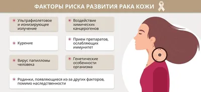 Опыт лечения плоскоклеточного рака кожи у пациентов с дистрофической формой  буллезного эпидермолиза uMEDp