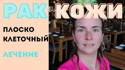 Плоскоклеточный рак кожи: стадии, симптомы, диагностика, методы лечения,  прогноз, выживаемость