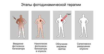 Плоскоклеточный рак кожи, самая начальная стадия. Болезнь Боуэна. —  nevus.pro