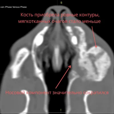 Опухоли у собак и кошек - Кошки обзор на Gomeovet