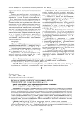 Плоскоклеточный рак анального канала, анального края, перианальной кожи.  Памятка для онкобольных и их родственников