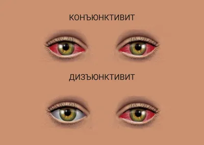 Несколько способов сделать красные глаза на фото | Создаем эффект красных  глаз