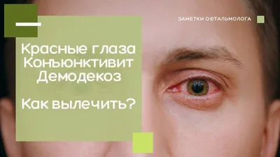 Как убрать «красные глаза» на фото | Программа от Movavi
