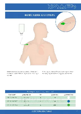 Катетер подключичный венозный КВ-1 (0,6) / Каммед (ID#118352428), цена:  63.84 ₴, купить на Prom.ua
