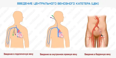 https://www.ozon.ru/product/kateter-podklyuchichnyy-sterilnyy-dlya-zhivotnyh-s-plastikovym-mandrenom-0-6h130-mm-5-sht-1205304773/