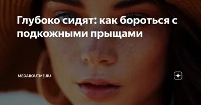 Антибиотик Авва рус Минолексин - «Антибиотик, который спас мою кожу! Отзыв  дополняю - увы, не спас :(» | отзывы