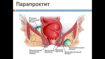 Ультразвуковая диагностика хронического парапроктита. | Тамбовская  областная клиническая больница имени В.Д. Бабенко