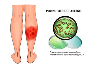 ✓Мозольный абсцесс это... - Кабинет лечебного педикюра | Facebook