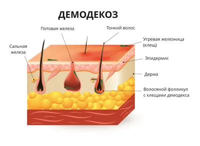 Демодекоз волосистой части головы — причины, симптомы, анализы, лечение