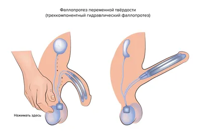 Из жизни Скорой помощи. \"- Доктор, вы только моего баклажана не  пугайтесь...\" | Пикабу