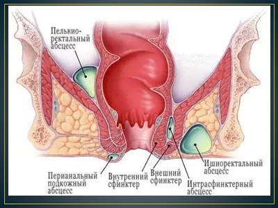 Диагностика и лечение тупой травмы полового члена