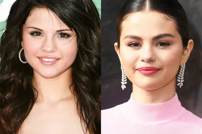 До и после: почему Белла Хадид, Кендалл Дженнер и другие звезды делают  подтяжку бровей | Glamour
