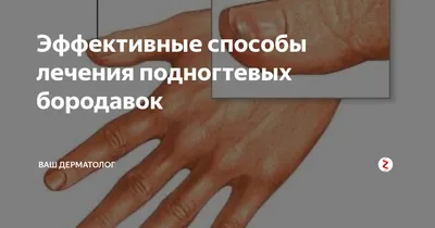 Удаление подногтевого мозоля — Квіткова 1, Одесса — Цена, Фото — Андрей