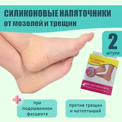 Удаление мозолей (стержневых,сухих) на ногах в Минске, лечение натоптышей  на ногах