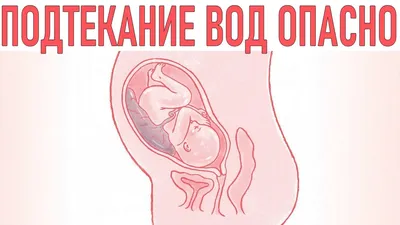 Фраутест тест для определения подтек. околоплод. вод купить в Москве по  цене от 708 рублей