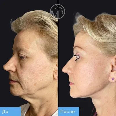 Фотографии до и после операций и косметических процедур