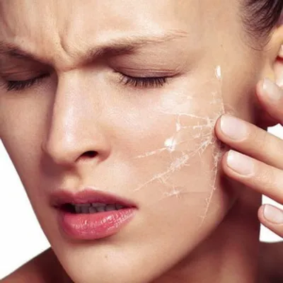 Беспокоит шелушение на лице Здраствуйте! беспокоит покраснение и шелушение  | MedAboutMe