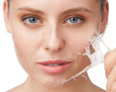 Почему появляется шелушение на лице | Teana Labs | Дзен