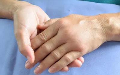 Сухая кожа рук — почему появляется сильная сухость, что делать