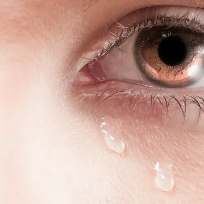 Покраснение, стягивание, шелушение в зоне вокруг глаз и на веках - Вопрос  дерматологу - 03 Онлайн