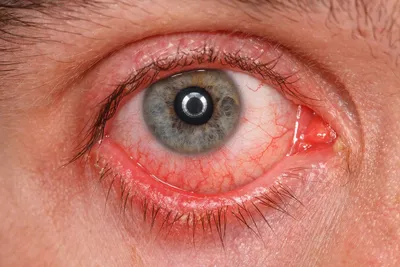 Крем для кожи вокруг глаз La Roche Posay Toleriane dermallergo YEUX -  «👁Всем чувствительным глазкам посвящается! Разберем состав, активные  ингредиенты, результат. Все плюсы и минусы.» | отзывы