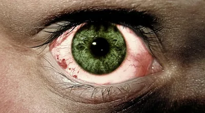 Покраснение кожи у ребенка вокруг глаз - Вопрос дерматологу - 03 Онлайн