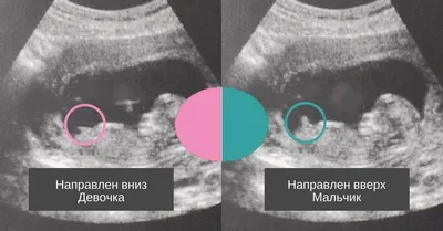 Как узнать пол ребёнка при беременности | ВКонтакте