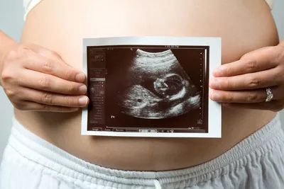 Пол малыша в 13 недель по Узи. Кто разбирается в снимках?) - Вопросы о  беременности - BabyPlan