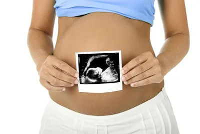 3D-УЗИ при беременности: мифы и реальность