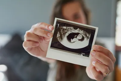 Беременность по неделям | Клиника ведения беременности в Пятигорске