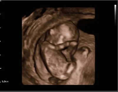 Фото УЗИ при беременности - «Не понимаю людей,которые отказываются  проходить УЗИ-скрининги при беременности, считая это вредной процедурой. На  мой взгляд это просто необходимо для каждой будущей мамочки. Ведь уже на УЗИ  Вы