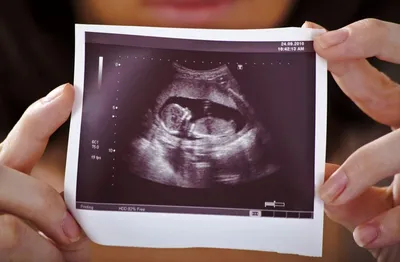 Как узнать пол ребёнка при беременности | ВКонтакте