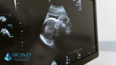 20 недель беременности | Клиника ведения беременности в Пятигорске