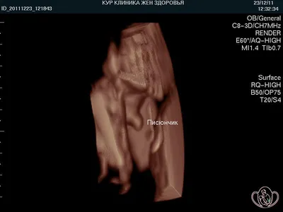 УЗИ при беременности в Южном Бутово в клинике «Доктор Борменталь» |  Определение беременности по УЗИ