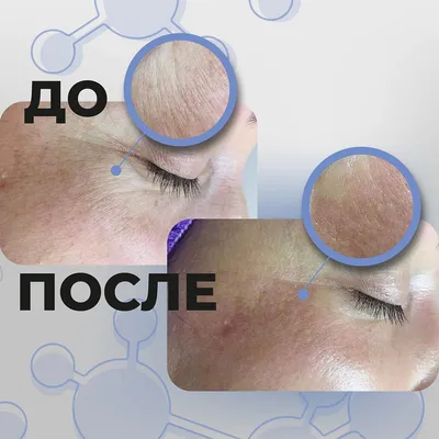 Купить Патчи под глаза с полинуклеотидами Dermaline Bio Activing PDRN Eye  patch, 60 шт. по лучшей цене от DERMALINE