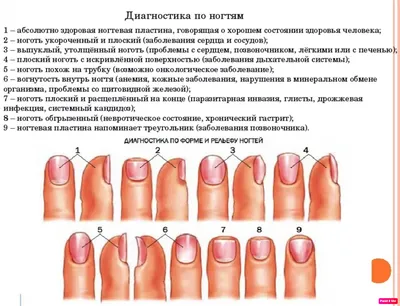 Черная полоска на руке на ногтях (75 фото) - картинки modnica.club