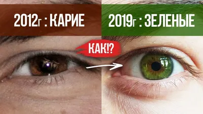 Как я поменял цвет глаз? Из КАРИХ в ЗЕЛЕНЫЕ! - YouTube