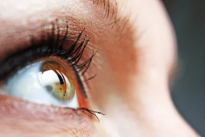 Как изменить цвет глаз? лазер, кератопигментация, имплант