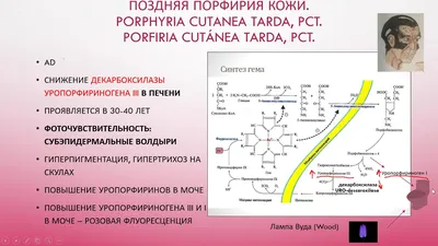 Вампиры существуют? Порфирия, мракобесие и фольклор | Пикабу