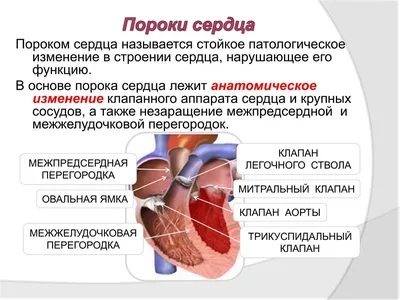 Лечение врожденного порока сердца в Морозовске, запись, цены | ООО Здоровье