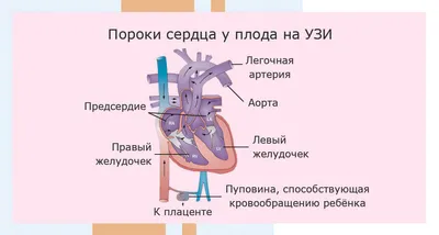 Врожденный порок сердца, причины | genetyka.com.ua