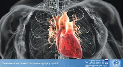 Врожденные пороки сердца | Клиника Эксперт