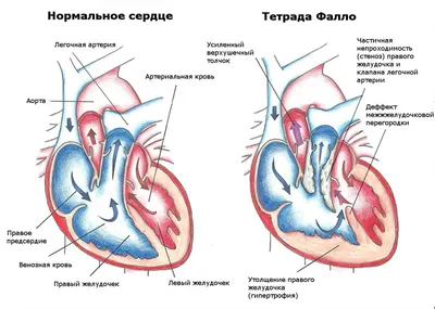 Современные подходы к диагностике врожденных пороков сердца