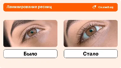 Наращивание ресниц: вред и польза процедуры, пошаговая инструкция по ее  проведению, длительность, противопоказания, уход | Косметология и  эстетическая медицина | Дзен