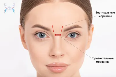 Ботокс (Botox) - Все что необходимо знать про Ботулотоксин - ЦИДК