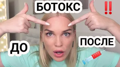 Птоз верхнего века как осложнение после ботокса - энциклопедия Ochkov.net