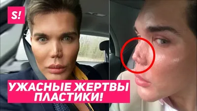 САМЫЕ ЖУТКИЕ ЖЕРТВЫ ПЛАСТИКИ / ЖИВЫЕ \"КЕНЫ\" 😨😱 - YouTube